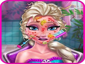 Ice Queen Doctor Game - Pimple Removal Online Game
